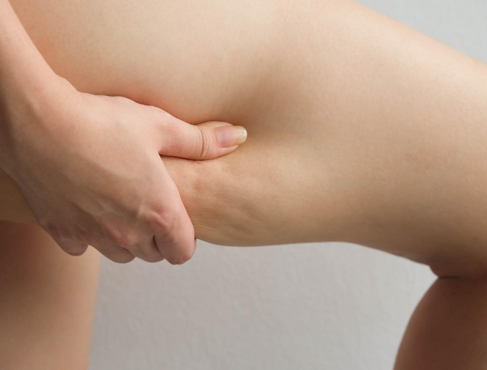 Cellulite effektiv behandeln mit Rotlichttherapie