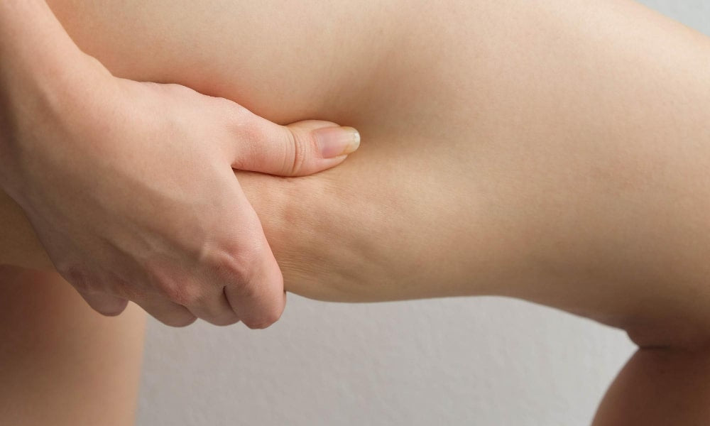 Cellulite effektiv behandeln mit Rotlichttherapie